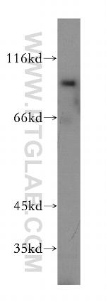 SSH3 Antibody in Western Blot (WB)