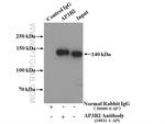 AP3B2 Antibody in Immunoprecipitation (IP)