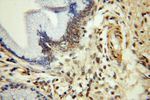 TBC1D22A Antibody in Immunohistochemistry (Paraffin) (IHC (P))