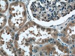 TBC1D22A Antibody in Immunohistochemistry (Paraffin) (IHC (P))