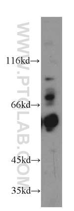 TBC1D22A Antibody in Western Blot (WB)