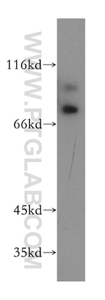 RAD18 Antibody in Western Blot (WB)