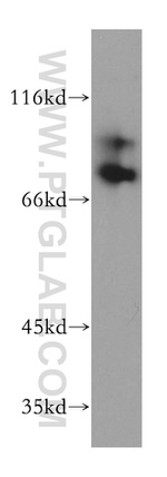 RAD18 Antibody in Western Blot (WB)