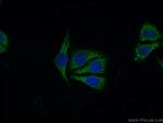 LSM14A Antibody in Immunocytochemistry (ICC/IF)