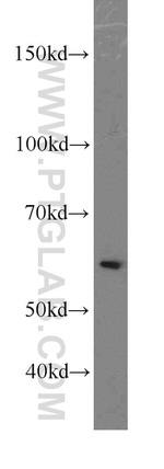 LSM14A Antibody in Western Blot (WB)