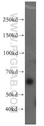 LSM14A Antibody in Western Blot (WB)