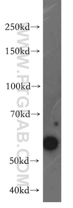 LSM14A Antibody in Western Blot (WB)