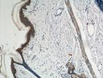 Plakophilin 3 Antibody in Immunohistochemistry (Paraffin) (IHC (P))