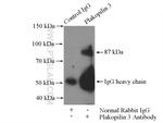 Plakophilin 3 Antibody in Immunoprecipitation (IP)