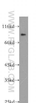 Plakophilin 3 Antibody in Western Blot (WB)