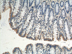 Plakophilin 3 Antibody in Immunohistochemistry (Paraffin) (IHC (P))