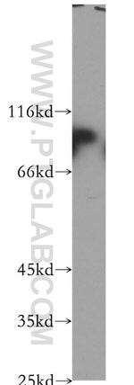 Plakophilin 3 Antibody in Western Blot (WB)