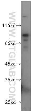 Plakophilin 3 Antibody in Western Blot (WB)