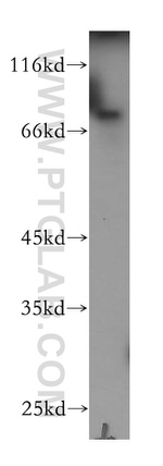 Plakophilin 3 Antibody in Western Blot (WB)