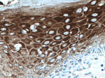 Cytokeratin 10 Antibody in Immunohistochemistry (Paraffin) (IHC (P))