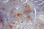 Cytokeratin 10 Antibody in Immunohistochemistry (Paraffin) (IHC (P))