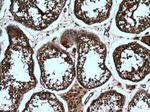 DTX1 Antibody in Immunohistochemistry (Paraffin) (IHC (P))