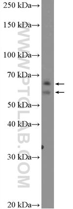 DTX1 Antibody in Western Blot (WB)