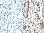 HNRNPL Antibody in Immunohistochemistry (Paraffin) (IHC (P))