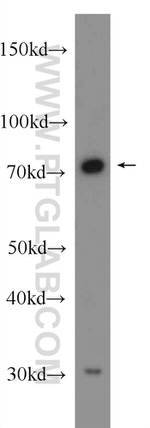 HNRNPL Antibody in Western Blot (WB)