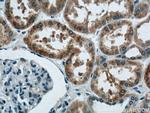 HNRNPL Antibody in Immunohistochemistry (Paraffin) (IHC (P))