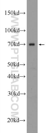 HNRNPL Antibody in Western Blot (WB)