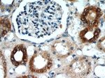 ANGPTL4 Antibody in Immunohistochemistry (Paraffin) (IHC (P))