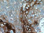 ANGPTL4 Antibody in Immunohistochemistry (Paraffin) (IHC (P))