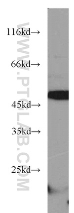 ANGPTL4 Antibody in Western Blot (WB)