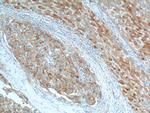 KISS1 Antibody in Immunohistochemistry (Paraffin) (IHC (P))