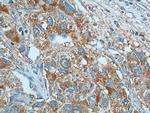 KISS1 Antibody in Immunohistochemistry (Paraffin) (IHC (P))