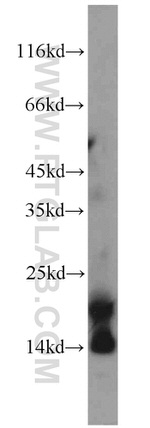 KISS1 Antibody in Western Blot (WB)