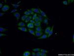 SLN Antibody in Immunocytochemistry (ICC/IF)