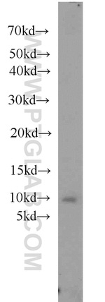 SLN Antibody in Western Blot (WB)