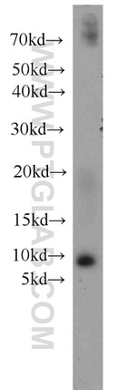 SLN Antibody in Western Blot (WB)