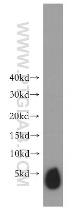 SLN Antibody in Western Blot (WB)