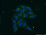 PSAP Antibody in Immunocytochemistry (ICC/IF)