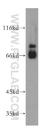 PSAP Antibody in Western Blot (WB)