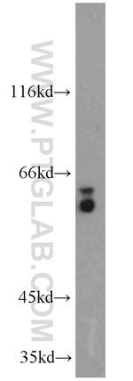 PSAP Antibody in Western Blot (WB)