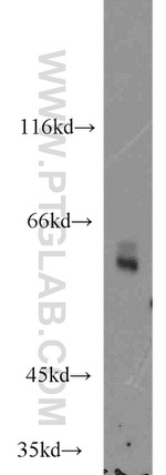 PSAP Antibody in Western Blot (WB)