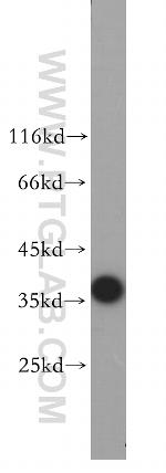 TOMM40 Antibody in Western Blot (WB)