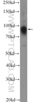 FURIN Antibody in Western Blot (WB)