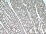 P62/SQSTM1 Antibody in Immunohistochemistry (Paraffin) (IHC (P))