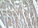 P62/SQSTM1 Antibody in Immunohistochemistry (Paraffin) (IHC (P))