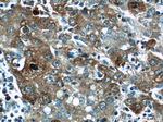 P62/SQSTM1 Antibody in Immunohistochemistry (Paraffin) (IHC (P))