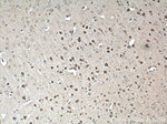 P62/SQSTM1 Antibody in Immunohistochemistry (Paraffin) (IHC (P))