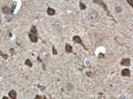 P62/SQSTM1 Antibody in Immunohistochemistry (Paraffin) (IHC (P))