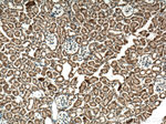 P62/SQSTM1 Antibody in Immunohistochemistry (Paraffin) (IHC (P))