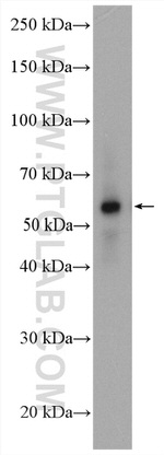 P62/SQSTM1 Antibody in Western Blot (WB)