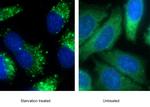 P62/SQSTM1 Antibody in Immunocytochemistry (ICC/IF)